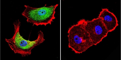 Immunofluorescence analysis of formaldehyde-fixed MCF7 cells, probed without (control, right panel) or with ab171117 (left panel) labeling ZNF259 (green) at a 1/20 dilution overnight. Slides were washed with PBS and incubated with a DyLight-488 conjugated secondary antibody. F-Actin was stained with Phalloidin (red) and nuclei with DAPI (blue).