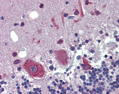 ab81251 at 5 µg/ml staining ZNF312B in Human cerebellum by Immunohistochemistry (Formalin/PFA-fixed paraffin-embedded sections).