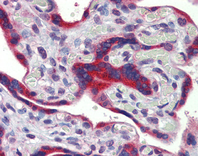 ab81251 at 5 µg/ml staining ZNF312B in Human placenta by Immunohistochemistry (Formalin/PFA-fixed paraffin-embedded sections).