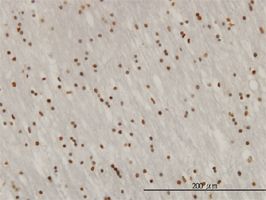 ZNF313 antibody (ab57452) used in immunohistochemistry at 3ug/ml on formalin fixed and paraffin embedded human lateral ventricle wall.