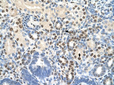 Immunohistochemistry (Formalin/PFA-fixed paraffin-embedded sections) analysis of human kidney tissue labelling ZNF326 with ab56246 at 4-8µg/ml. Arrows indicate positively labelled epithelial cells of the renal tubule. Magnification: 400X.