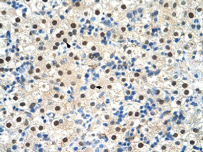 Immunohistochemistry (Formalin/PFA-fixed paraffin-embedded sections) analysis of human liver tissue labelling ZNF326 with ab56246 at 4-8µg/ml. Arrows indicate positively labelled hepatocytes. Magnification: 400X.