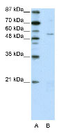 Anti-ZNF329 antibody (ab50781) at 2.5 µg/ml + HepG2 Cell Lysate at 10 µgSecondaryHRP conjugated anti-Rabbit IgG at 50000