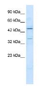 Anti-ZNF358 antibody (ab28678) at 1.25 µg/ml + Jurkat Cell LysateSecondaryRabbit Anti ZNF358 Antibody at 1/50000 dilution