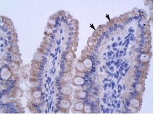 Ab28678, at concentration of 4.0-8.0 &microg/ml, staining ZNF358 in paraffin embedded human epithelial cells of intestinal villus by Immunohistochemistry. Arrows point to positively labelled cells. Magnification: 400x.