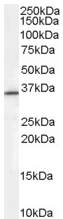 Anti-ZNF364 antibody (ab52016) at 0.3 µg/ml + HEPG2 cell lysate (35µg protein in RIPA buffer).