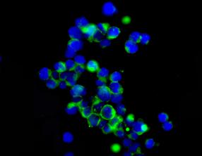 Immunofluorescent analysis of Jurkat cells labeling ZNF365 with ab157459 at 1/50 dilution.
