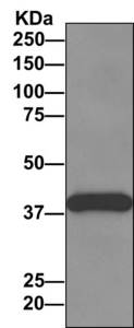 Detection of ZNF365 by Western Blot of Immunprecipitate. Jurkat cell lysate immunoprecipitated using ab157459 at 1/10 dilution.