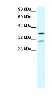 Anti-ZNF385 antibody (ab42458) at 0.5 µg/ml + Fetal brain lysateSecondaryHRP conjugated anti-Rabbit IgG at 1/75000 dilution