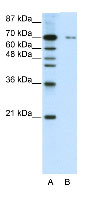 Anti-ZNF398 antibody (ab50771) at 0.5 µg/ml + HepG2 Cell Lysate at 10 µgSecondaryHRP conjugated anti-Rabbit IgG at 50000