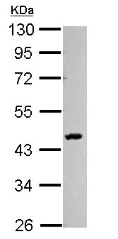 Anti-SMYD3 antibody (ab155018) at 1/1000 dilution + 293T whole cell lysate at 30 µg