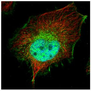 Confocal immunofluorescent analysis of paraformaldehyde-fixed HeLa cells labeling SMYD3 with ab155018 at 1/500 dilution (green). Alpha-tubulin filaments were labeled with an Alpha-tubulin antibody at 1/2000 dilution (red).