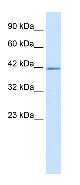 Anti-ZNFN1A2 antibody (ab30971) at 5 µg/ml + HepG2 cells lysate at 10 µg/mlSecondaryHRP-conjugated anti-rabbit