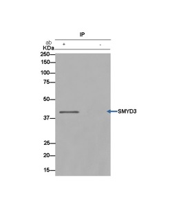 Immunoprecipitation of HeLa cells labeling SMYD3 with ab183498 at 1/50 dilution and Anti-Rabbit IgG (HRP), specific to the non-reduced form of IgG at 1/1500.