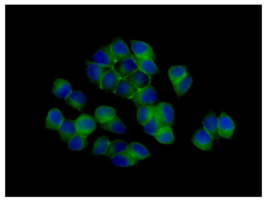 Immunofluorescent analysis of 4% paraformaldehyde-fixed MCF7 cell line staining Zonula occludens protein 3 using ab181991 at a 1/250 dilution (green). Goat anti rabbit IgG (Dylight 488) was used as a secondary antibody, at a dilution of 1/200. Counter stain: Dapi (blue).