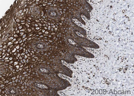Image courtesy of Human Protein Atlasab16027 staining SMYD3 in Human cervix. Paraffin embedded human uterine tissue was incubated with ab16027 (1/75) for 30 minutes at room tempetrature. Antigen retrieval was performed by heat induction in citrate buffer pH 6. ab16027 was tested in a tissue microarray (TMA) containing a wide range of normal and cancer tissues as well as a cell microarray consisting of a range of commonly used, well characterised human cell lines. Further results for this antibody can be found at www.proteinatlas.org