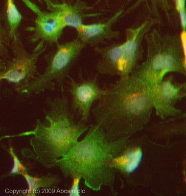 ICC/IF image of ab71842 stained HepG2 cells. The cells were 4% PFA fixed (10 min) and then incubated in 1%BSA / 10% normal Goat serum / 0.3M glycine in 0.1% PBS-Tween for 1h to permeabilise the cells and block non-specific protein-protein interactions. The cells were then incubated with the antibody (ab71842, 5µg/ml) overnight at +4°C. The secondary antibody (green) was Alexa Fluor® 488 Goat anti-Rabbit IgG (H+L) used at a 1/1000 dilution for 1h. Alexa Fluor® 594 WGA was used to label plasma membranes (red) at a 1/200 dilution for 1h. DAPI was used to stain the cell nuclei (blue) at a concentration of 1.43µM. This antibody also gave a positive result in 4% PFA fixed (10 min) HeLa cells at 5µg/ml, and in 100% Methanol fixed (5 min) Hela, Hek293, HepG2, and MCF-7 cells at 5µg/ml.