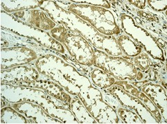 Immunohistochemical analysis of Zyxin in paraffin embedded Human kidney tissue, using ab109316 at a 1/250 dilution.