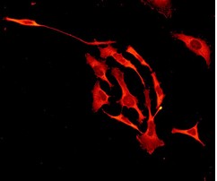 Immunofluorescent staining of Zyxin in HeLa cells, using ab109316 at a 1/100 dilution.