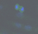 Immunofluorescence staining of SIRT2 in transfected SAOS2 cells using ab19388.