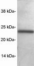 Western blot detection of SNAP23 on rat brain protein extract using ab3340.
