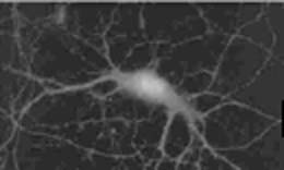 Immunlocalization of SNAP-25 in cultured rat hippocampal cells using ab5666. 