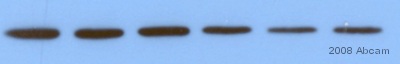 Anti-SNAP25 antibody (ab5666) at 1/10000 dilution + Whole tissue lysate prepared from mouse hippocampus.SecondaryHRP conjugated goat anti-rabbit Ig. at 1/10000 dilutiondeveloped using the ECL techniquePerformed under reducing conditions.Observed band size : 25 kDa (why is the actual band size different from the predicted?)Exposure time :  20 secondsThis image is courtesy of an anonymous AbreviewSee Abreview