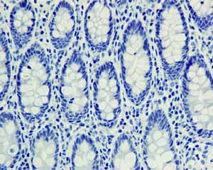 ab108990 showing negative staining in Normal colon tissue.