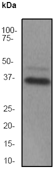 Anti-SIRT2 antibody [EP1668Y] (ab51023) at 1/1000 dilution + SKBR-3 cell lysate at 10 µgSecondaryGoat anti-rabbit HRP labeled at 1/2000 dilution