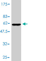 Western blot against tagged recombinant protein immunogen using ab56566 SNAP29 antibody at 1ug/ml.