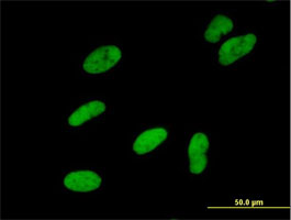 Immunofluorescence analysis of HeLa cells, labeling SNF2H with ab168653 at 10 µg/ml.