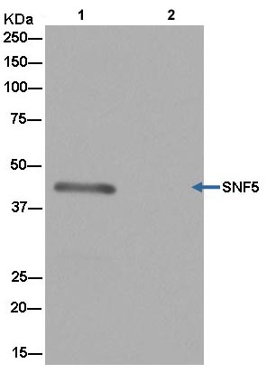 Western blot analysis of HeLa cell lysate immunoprecipitated with ab181976 at 1/50 dilution (Lane 1). Lane 2: Negative control. Anti-Rabbit IgG (HRP) secondary antibody, specific to the non-reduced form of IgG used at 1/1500 dilution.