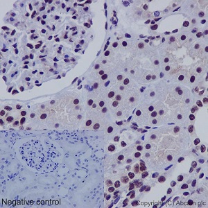 Immunohistochemical analysis of paraffin embedded Human kidney tissue sections labeling SNF5 using ab192864 at a 1/1000 dilution. A prediluted HRP Polymer for Rabbit IgG was used as the secondary. Hematoxylin counterstain.
