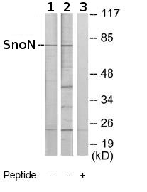 All lanes : Anti-SnoN antibody (ab69994) at 1/500 dilutionLane 1 : Extracts from HUVEC cells, minus immunising peptideLane 2 : Extracts from Jurkat cells, minus immunising peptideLane 3 : Extracts from HUVEC cells, plus immunising peptide at 5µgLysates/proteins at 5 µg per lane.