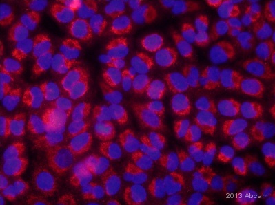 ab128079 staining SnoN in the A549 cell line from Human Lung by ICC/IF (Immunocytochemistry/immunofluorescence). Cells were fixed with paraformaldehyde and permeabilized with Triton X-100 0.25% in PBS. Samples were incubated with primary antibody (1/100) for 45 minutes at 25°C. A TRITC-conjugated Gaot anti-mouse IgG polyclonal was used as the secondary antibody.See Abreview