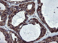 ab128079, at 1/150 dilution, staining SnoN in paraffin-embedded Human breast tissue by Immunohistochemistry.