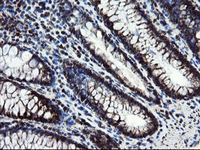 ab128079, at 1/150 dilution, staining SnoN in paraffin-embedded Human colon tissue by Immunohistochemistry.