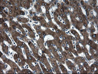ab128079, at 1/150 dilution, staining SnoN in paraffin-embedded Human liver tissue by Immunohistochemistry.