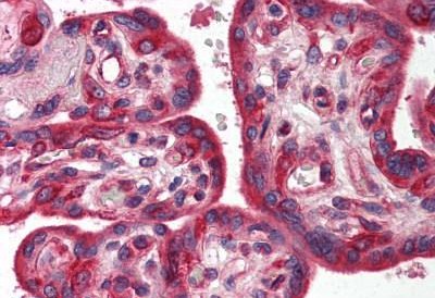 Immunohistochemical analysis of formalin-fixed, paraffin-embedded human placenta tissue labeling SnoN with ab189653 at 5 µg/ml.