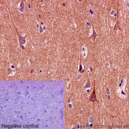 Immunohistochemical analysis of formalin fixed paraffin embedded human brain labeling SNPH with ab192605 at 1/1000 (1μg/ml) dilution and HRP Polymer to Rabbit/mouse IgG as secondary. Counterstained with Hematoxylin.
