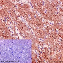 Immunohistochemical analysis of formalin fixed paraffin embedded mouse brain labeling SNPH with ab192605 at 1/1000 (1μg/ml) dilution and HRP Polymer to Rabbit/mouse IgG as secondary. Counterstained with Hematoxylin.