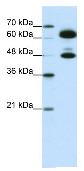 Anti-SNRP70 antibody (ab51266) at 0.25 µg/ml (in 5% skim milk / PBS buffer) + HepG2 cell lysate at 10 µgSecondaryHRP conjugated anti-Rabbit IgG at 1/50000 dilution