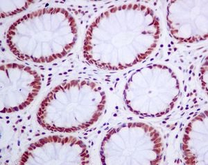 ab128865, at 1/50 dilution, staining SNRPA1 in paraffin-embedded Human colon tissue by Immunohistochemistry.