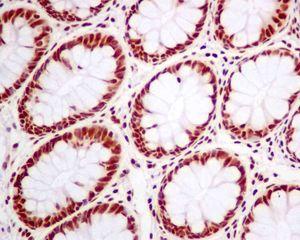ab128937, at a 1/100 dilution, staining SNRPA1 in paraffin-embedded Human colon tissue by immunohistochemistry.