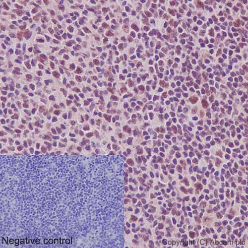 Immunohistochemical analysis of paraffin-embedded Human tonsil tissue labeling SNRPC with ab192028 at 1/1000 dilution, followed by prediluted HRP Polymer for Rabbit/Mouse IgG. Counter stained with Hematoxylin. The negative control utilised PBS instead of primary antibody.