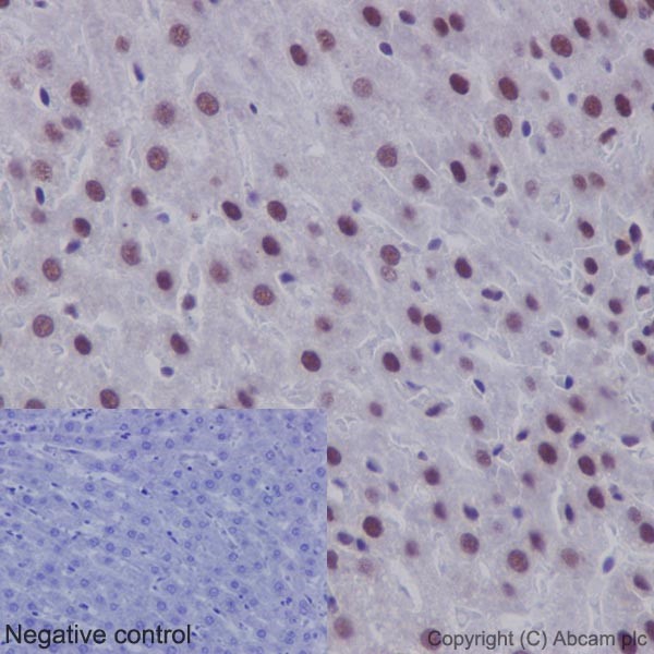 Immunohistochemical analysis of paraffin-embedded Rat liver tissue labeling SNRPC with ab192028 at 1/1000 dilution, followed by prediluted HRP Polymer for Rabbit/Mouse IgG. Counter stained with Hematoxylin. The negative control utilised PBS instead of primary antibody.