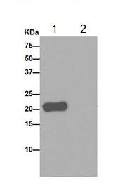 Western blot analysis of SNRPC in K562 lysate immunoprecipitated using ab192028 at 1/40 dilution (Lane 1). Lane 2: PBS instead of K562 lysate. Secondary antibody: Anti-Rabbit IgG (HRP), specific to the non-reduced form of IgG at 1/1500 dilution.Blocking/dilution buffer: 5% NFDM/TBST.