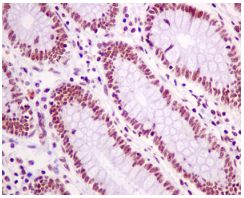 Immunohistochemical analysis of paraffin-embedded Human colon tissue labeling SNRPF with ab154870 at 1/50 dilution.