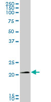 Anti-SNX10 antibody (ab76815) at 1/500 dilution + human kidney tissue lysate at 25 µgSecondaryGoat Anti-Mouse IgG (H&L) HRP-conjugated at 1/2500 dilution