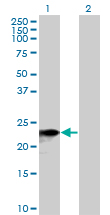 All lanes : Anti-SNX10 antibody (ab76815) at 1/500 dilutionLane 1 : SNX10 transfected 293T cell lysateLane 2 : Non transfected 293T cell lysateLysates/proteins at 25 µg per lane.SecondaryGoat Anti-Mouse IgG (H&L) HRP-conjugated at 1/2500 dilution